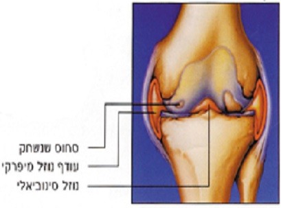 שחיקת סחוס