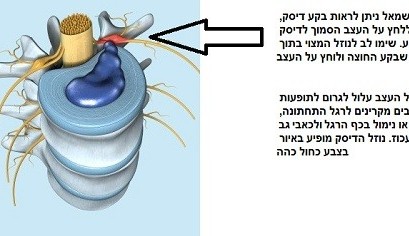 הסבר על פריצת דיסק