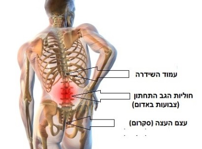 סיאטיקה