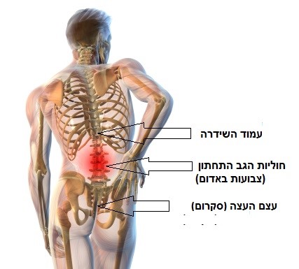 Backache Man
