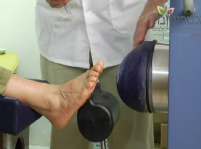 גלי הלם לטיפול בדורבן העקב