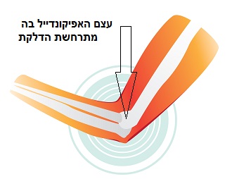 גולף אלבו