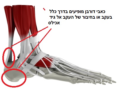כאב בעקב